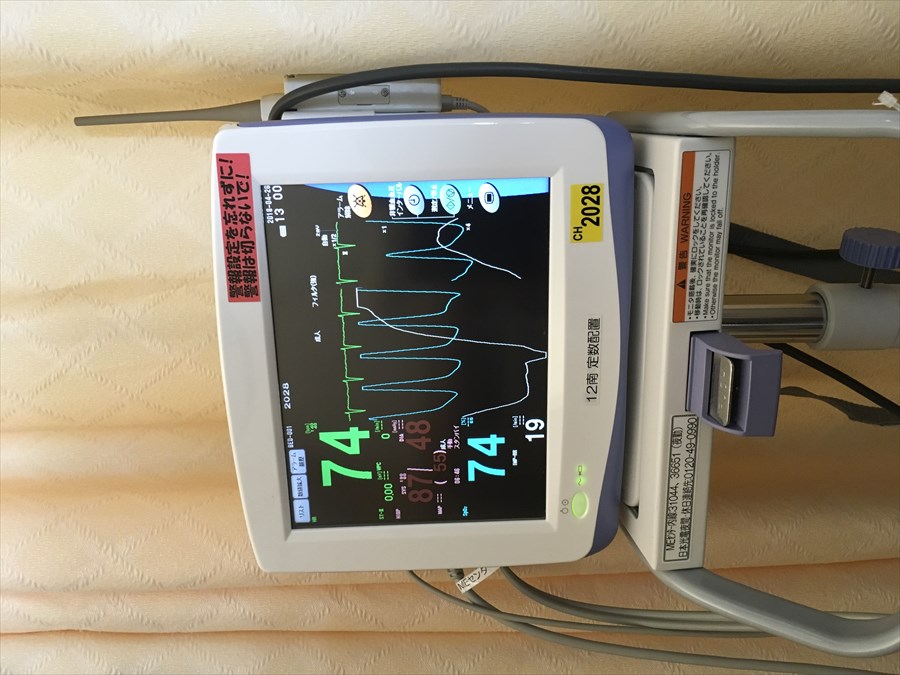手術前の心電図モニターの写真